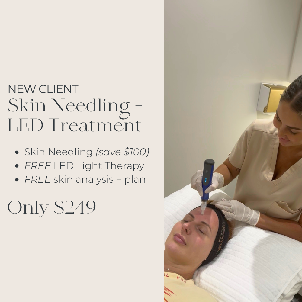 New Client Skin Needling with Consultation & LED