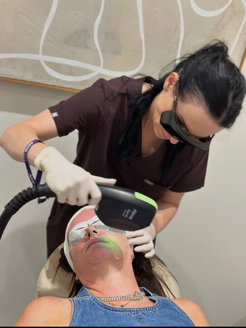 IPL Laser Treatment in Wollongong